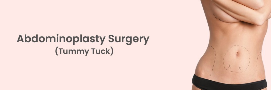 Tummy Tuck Surgery in Hyderabad