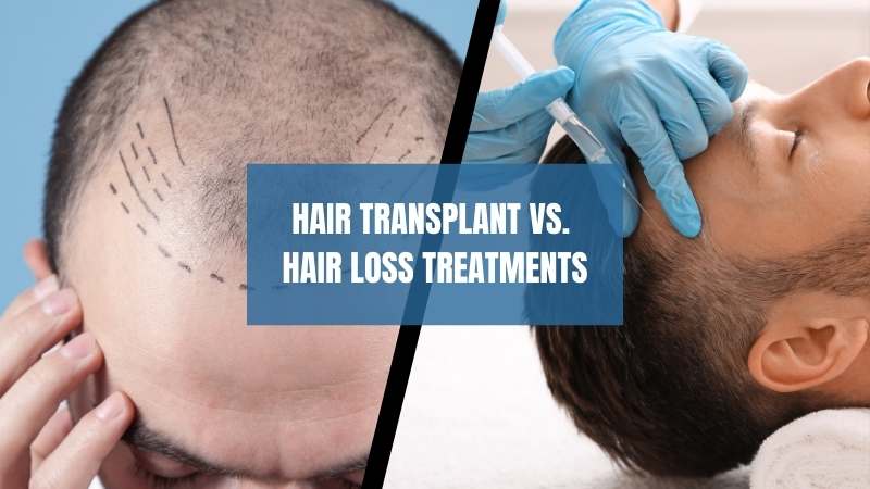 Hair Transplant vs. Hair Loss Treatments
