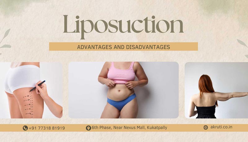 Liposuction Advantages Disadvantages