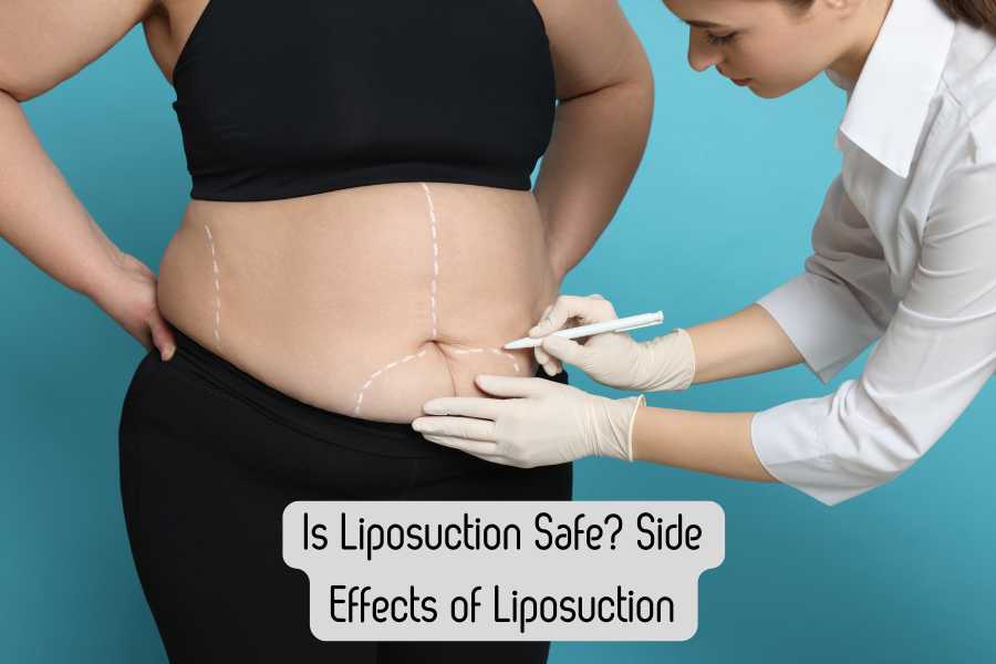 Side Effects of Liposuction