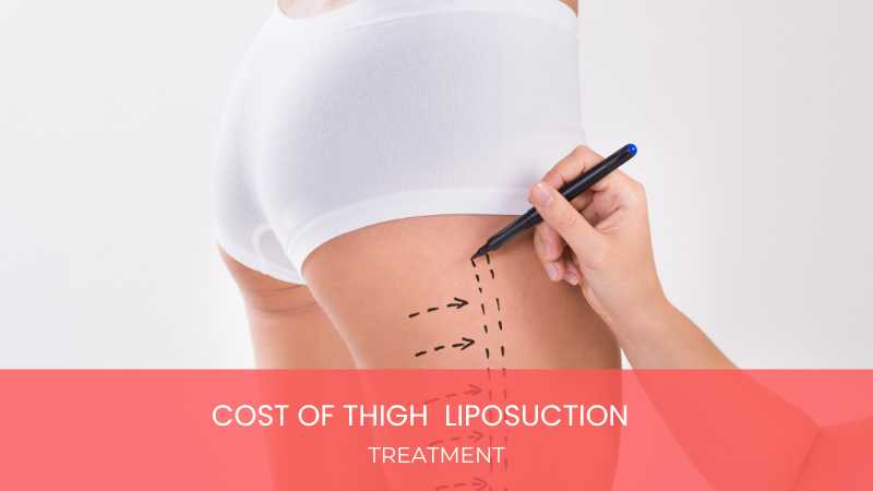 Thigh Liposuction Cost in Hyderabad