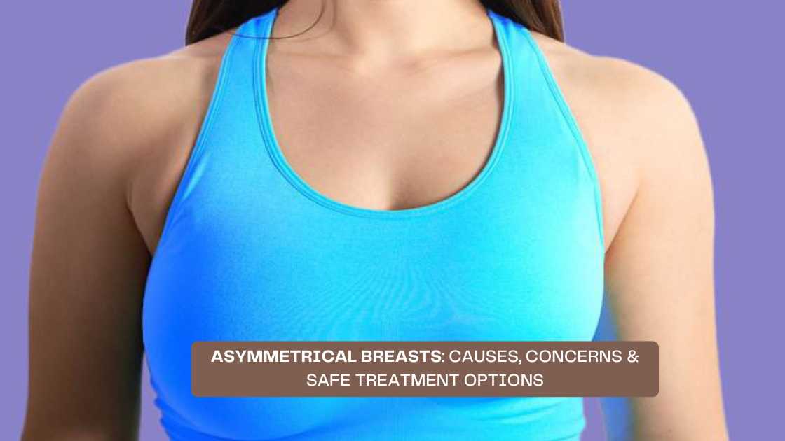 Asymmetrical Breasts Causes, Concerns Treatment