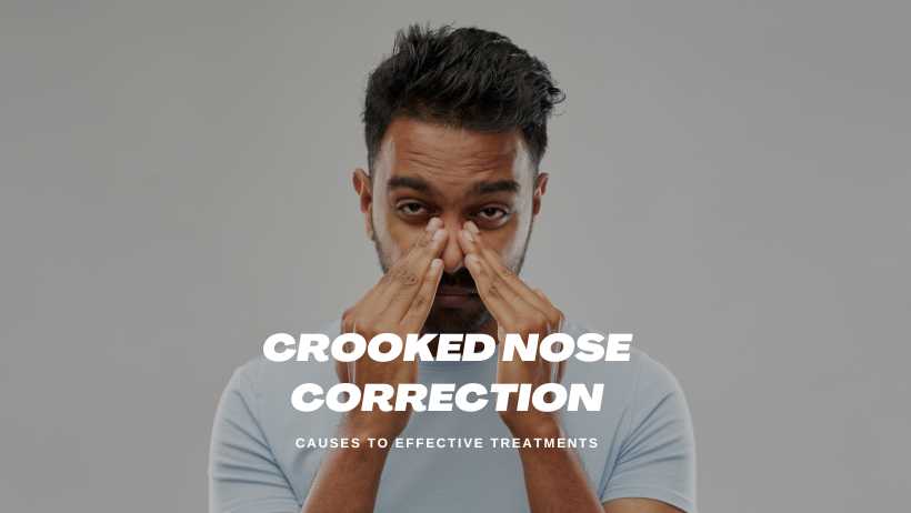 Crooked Nose Correction