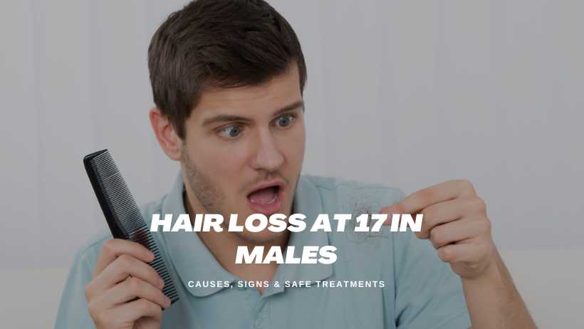 Hair Loss at 17 in Males