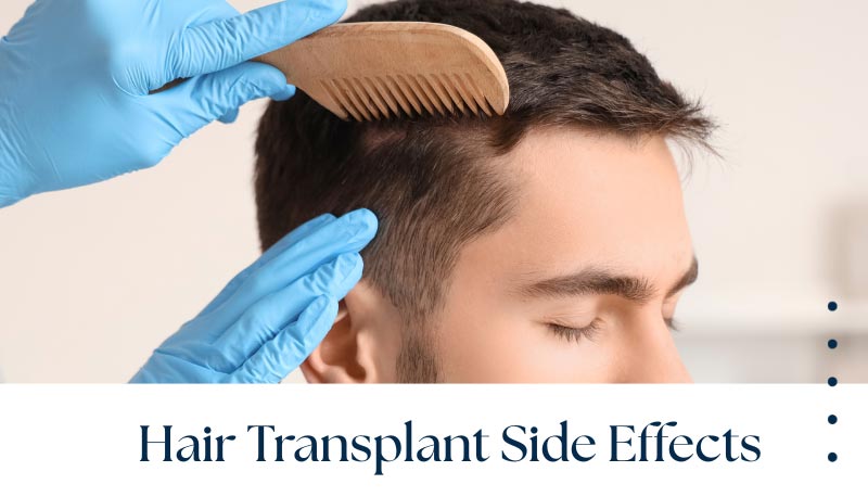 Hair Transplant Side Effect