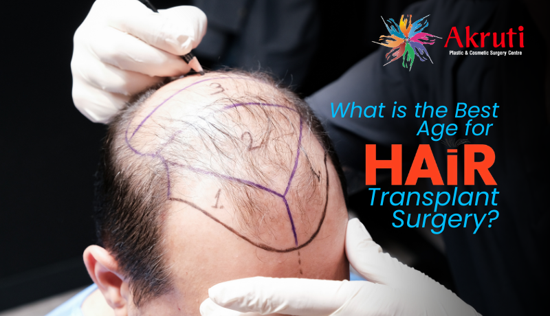 AKRUIT HAIR TRANSPLANT SURGERY What is the Best Age for Hair Transplant Surgery?