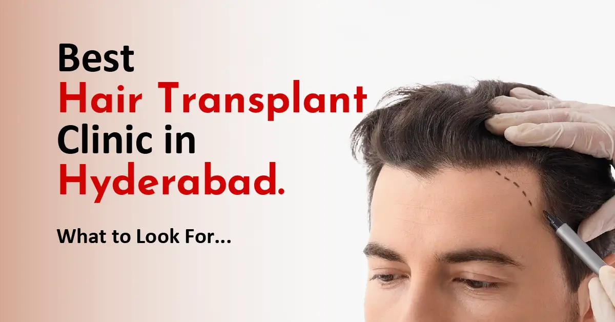 best-hair-transplant-clinic-in-hyderabad-what-to-look-for Best Hair Transplant Clinic in Hyderabad – What to Look For
