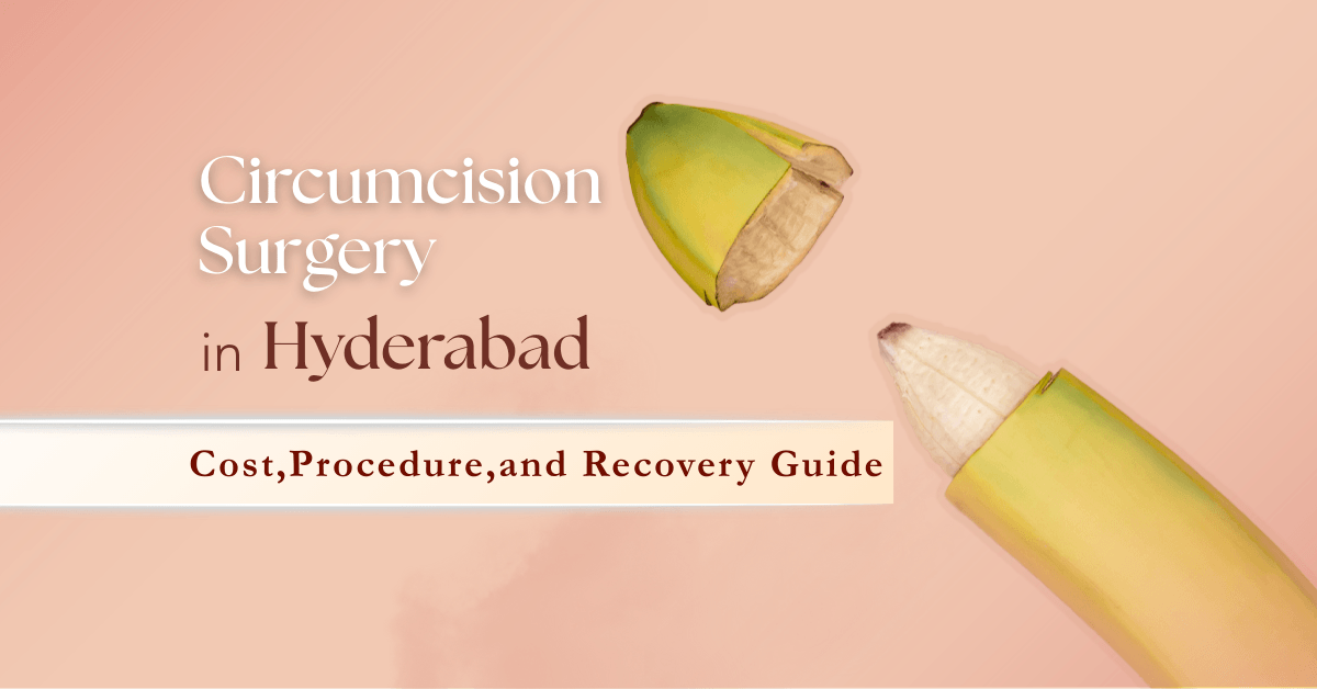 Circumcision Surgery in Hyderabad: Cost, Procedure, and Recovery Guide