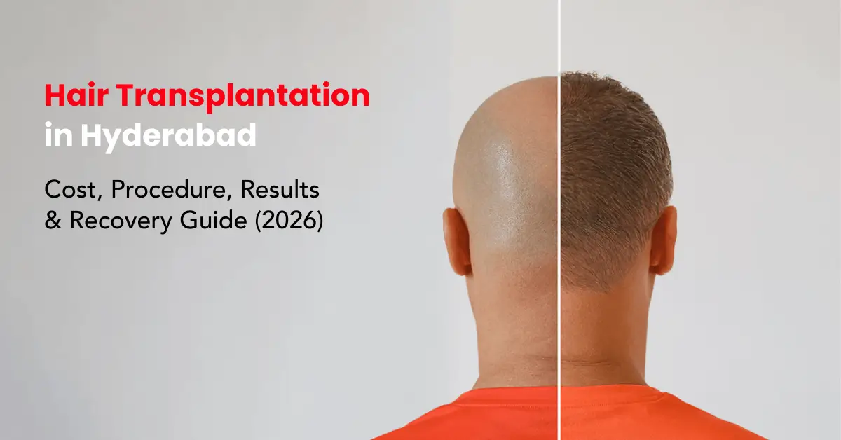 hair-transplantation-in-hyderabad-cost-procedure-results-recovery-2026-guide Hair Transplantation in Hyderabad: Cost, Procedure, Results & Recovery (2026 Guide)