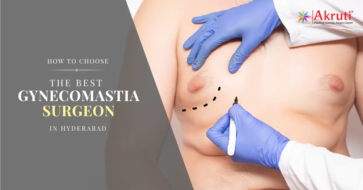 how-to-choose-the-best-gynecomastia-surgeon-in-hyderabad How to Choose the Best Gynecomastia Surgeon in Hyderabad