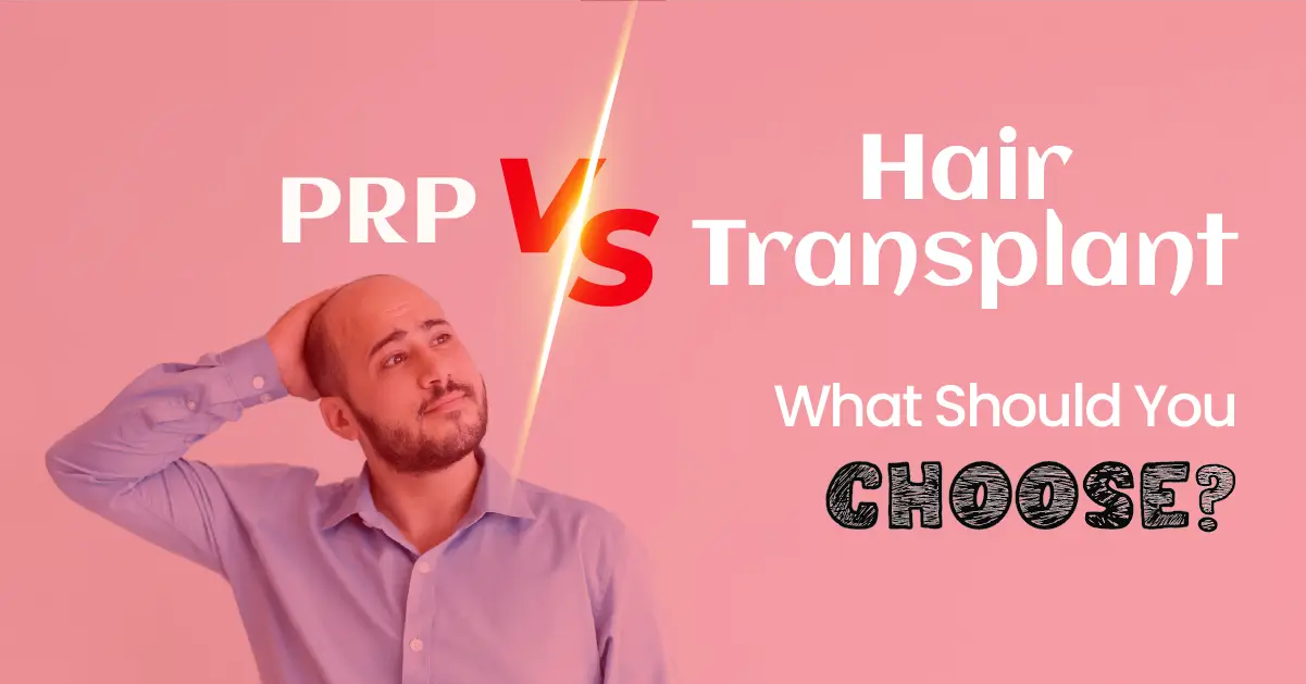 prp-vs-hair-transplant PRP vs Hair Transplant – What Should You Choose?