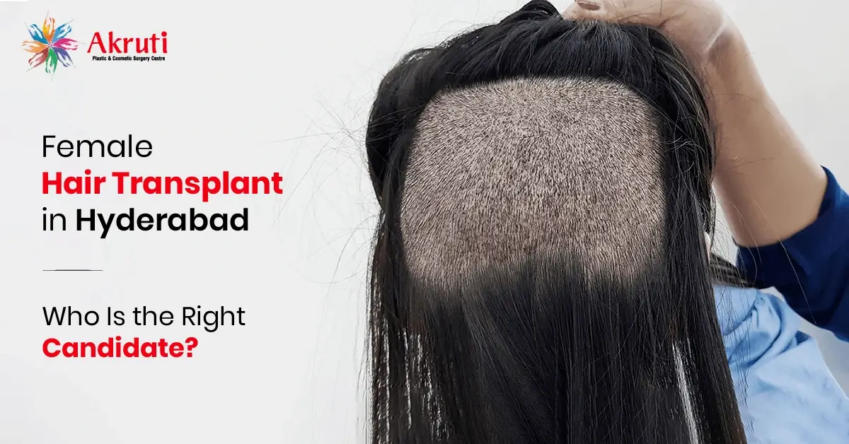 Female Hair Transplant in Hyderabad