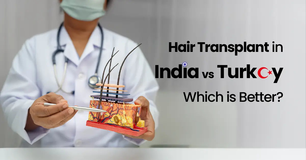 Hair Transplant in India vs Turkey - Which is Better? | AKruti
