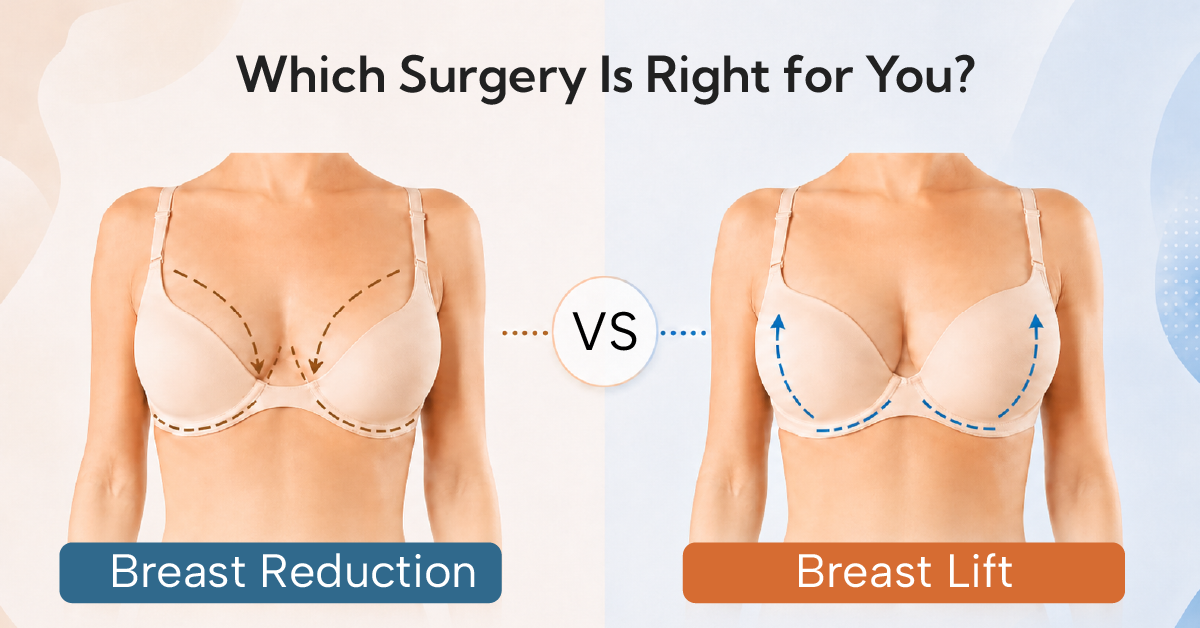 Breast Reduction vs. Breast Lift: Which Surgery Is Right for You?