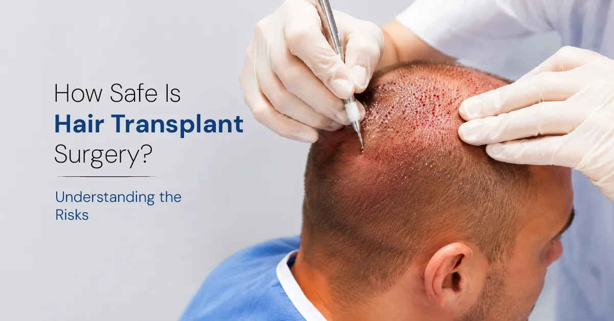 How Safe Is Hair Transplant Surgery?