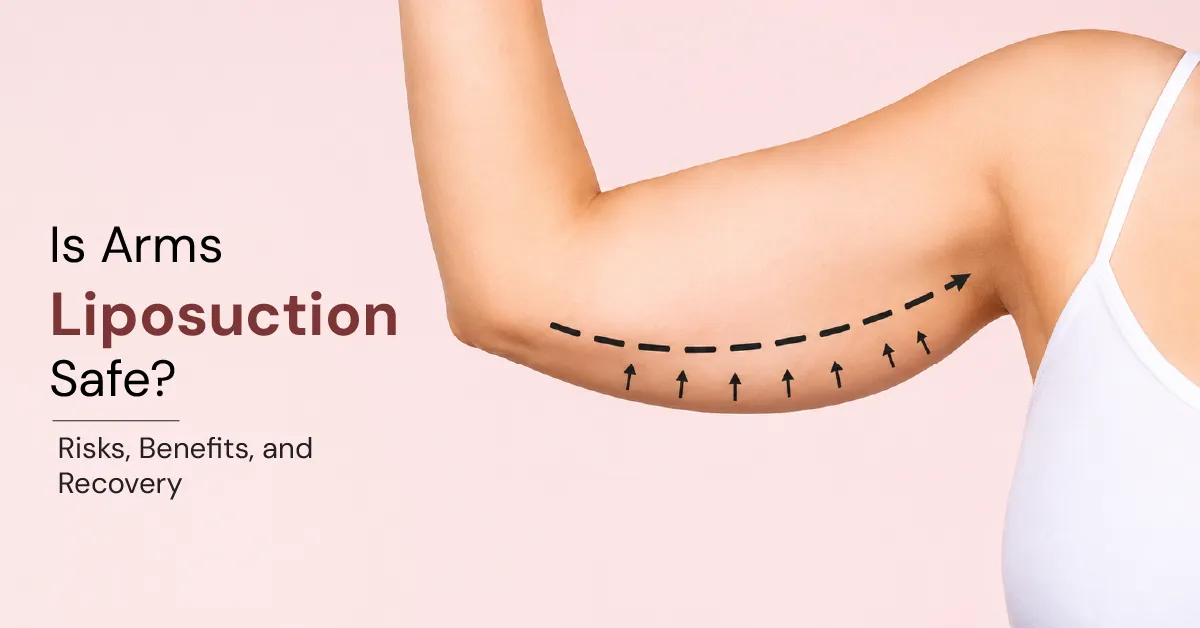 Is Arms Liposuction Safe? Risks, Benefits, and Recovery