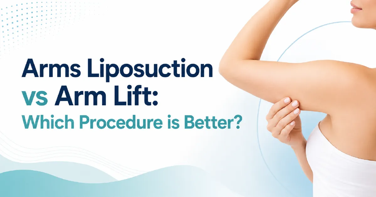 Arms Liposuction vs Arm Lift: Which Procedure is Better?